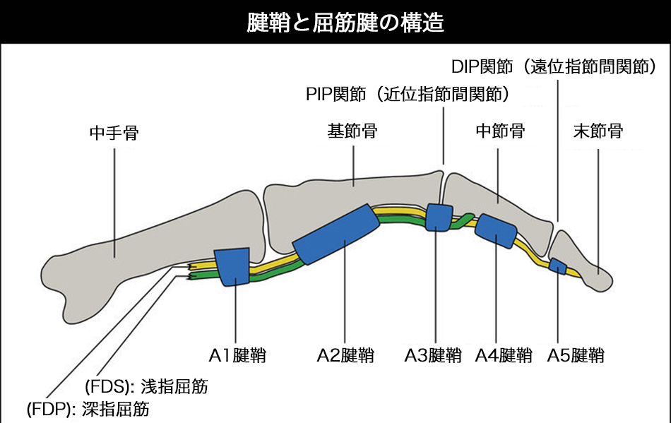 HANG RIGHT PART 3：しつこい指の故障を治す