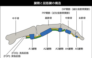 HANG RIGHT PART 3：しつこい指の故障を治す